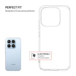 Fixed Story AntiUV | Back cover | Xiaomi | 17 | TPU | Clear